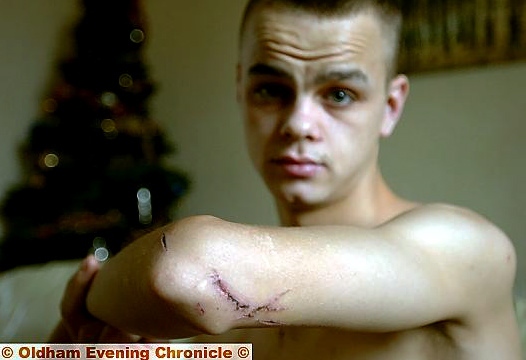 TEENAGER Steven Allt after the attack, which left him with wounds to the head, arm and chest. 
