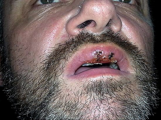 Stuart Corry mouth injuries