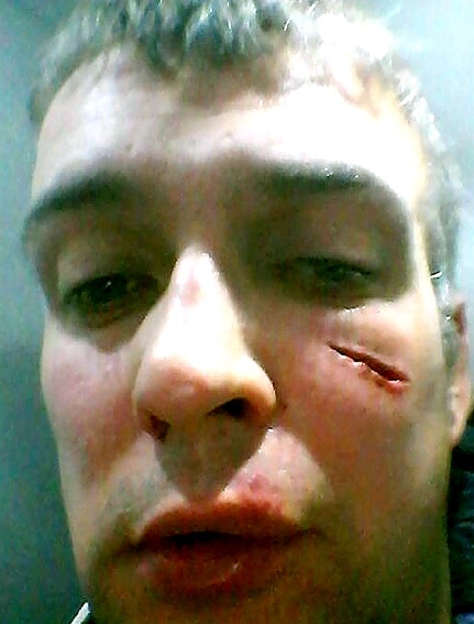 Brian Shawcross: face slashed