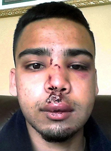 Syed Adnan Mashrur who was attacked at Newbold Tram Station 