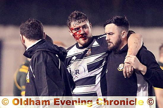 JACK Connor, of Saddleworth Rangers, is helped off the field after receiving a bang to the face. 