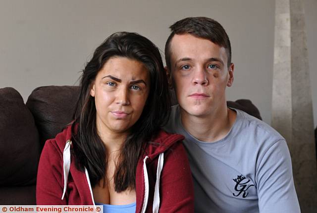 BOXER Andy Kremner and his girlfriend Nicola Mellor were both injured in a hit and run incident