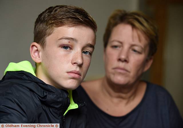 Harrison Dale was assaulted and had his phone and bike stolen. PIC with mum Barbara Dale.