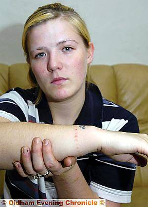 STILL SHAKEN. . . Teenager Sarah Ashworth holds her arm, injured when it was trapped in a bus door
STILL SHAKEN. . . Teenager Sarah Ashworth holds her arm, injured when it was trapped in a bus door