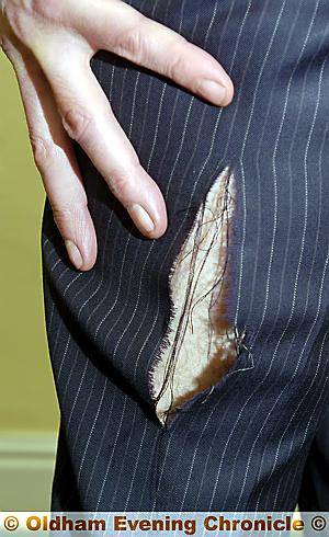 THE damage caused to Mr Comyn-Platt's trousers 