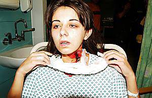 RACHEL SHAW . . . survived 