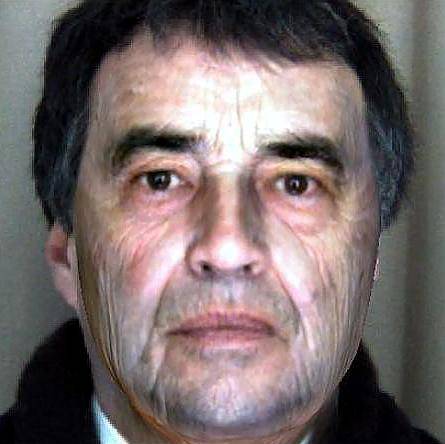 AFTER: virtual view of how he could look 