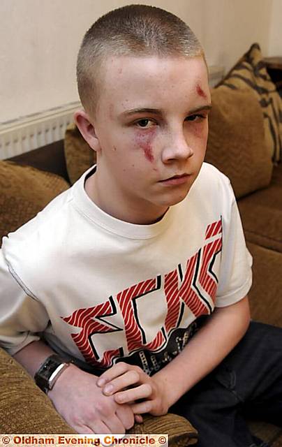 BATTERED and bruised . . . James BATTERED and bruised . . . James