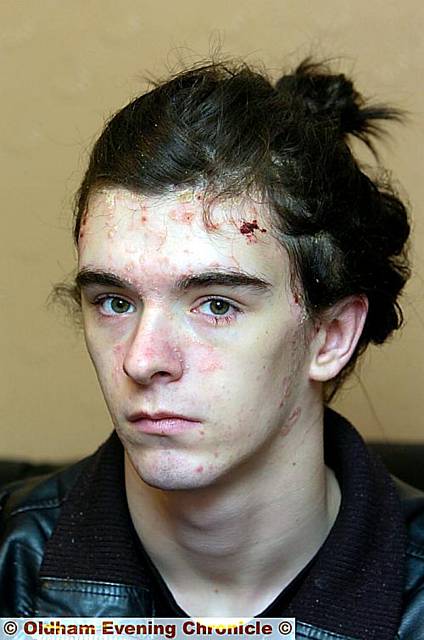 BADLY beaten . . . assault victim Patrick O’Brien 