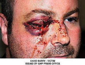 THE terrible injuries Dave Barry suffered which cost him his right eye 