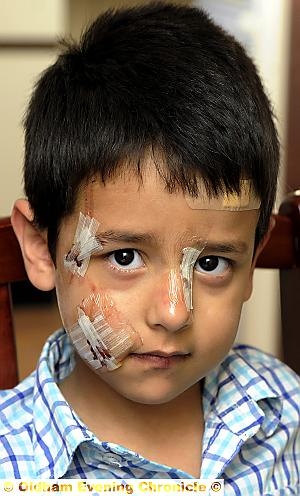 SCARRED: five-year-old Muhammad Abdullah Shahid
SCARRED: five-year-old Muhammad Abdullah Shahid