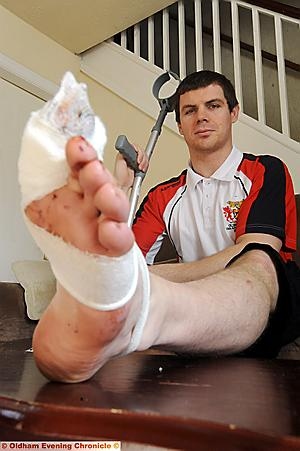 WHAT a nightmare: John recovers at home following his toe operation WHAT a nightmare: John recovers at home following his toe operation