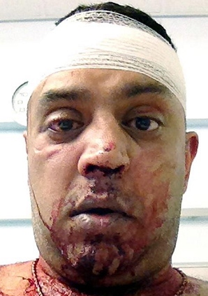 BEATEN . . . bar owner Ajay Javer BEATEN . . . bar owner Ajay Javer
