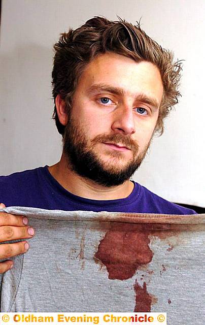 BLOODIED . . . Craig and his blood-stained T-shirt 