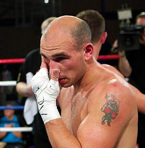 Craig watson: bout off due to shoulder injury
Craig watson: bout off due to shoulder injury