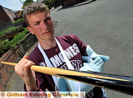 Reece Shearer: pool cue skewered his hand
Reece Shearer: pool cue skewered his hand