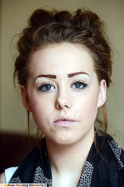 Chloe Walker - savaged by a dog in 2011 and now scarred for life. 
