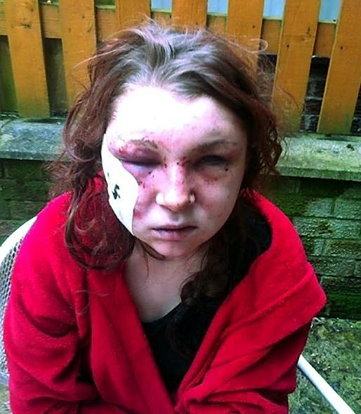 HORRIFIC injuries . . . Megan Birch 