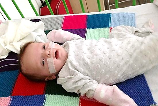 IN recovery: little Lily Limb is recovering at Manchester Children’s Hospital after being diagnosed with the ultra-rare and life-threatening condition Vein of Galen Malformation (VGM)
