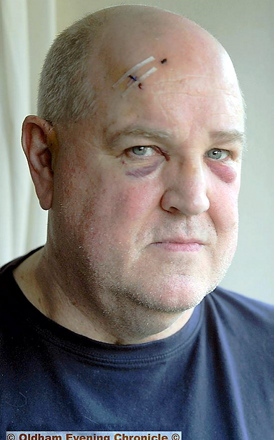 “THEY could have killed me”... Mark Coope (54) attacked with glass bottles on his own doorstep
