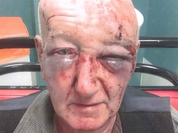 assault victim Derek Laidlaw