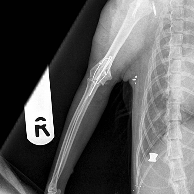 X rays showing Cheryl William's cat Cocos injuries after it suffered a broken leg and was shot by a pellet gun. X rays show pellets still inside cat.
