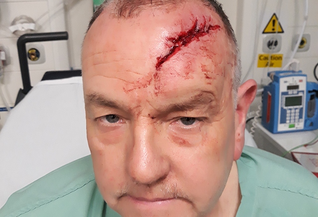 Paul Schofield suffered a horrendous head injury.

Picture courtesy of Greater Manchester Police