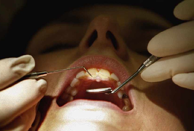 Oldham’s oral health has improved by 16.1-per-cent since the last survey in 2014/15 Oldham’s oral health has improved by 16.1-per-cent since the last survey in 2014/15