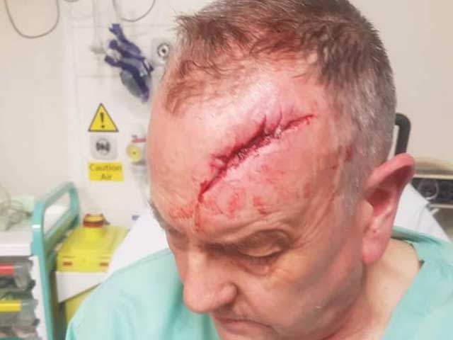 The 58-year old man suffered a serious head injury