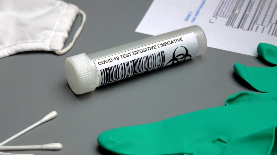 You can get a PCR test if you are displaying symptoms You can get a PCR test if you are displaying symptoms