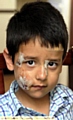 SCARRED: five-year-old Muhammad Abdullah Shahid 
