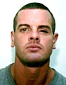Dale Cregan: losing sight in remaining eye