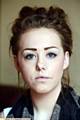 Chloe Walker - savaged by a dog in 2011 and now scarred for life. 
