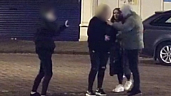 The victim was treated at the scene by ambulance staff and at hospital for a bleed on the brain