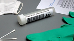 You can get a PCR test if you are displaying symptoms
